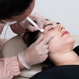 Jato de Plasma – Clínica de Estética BH