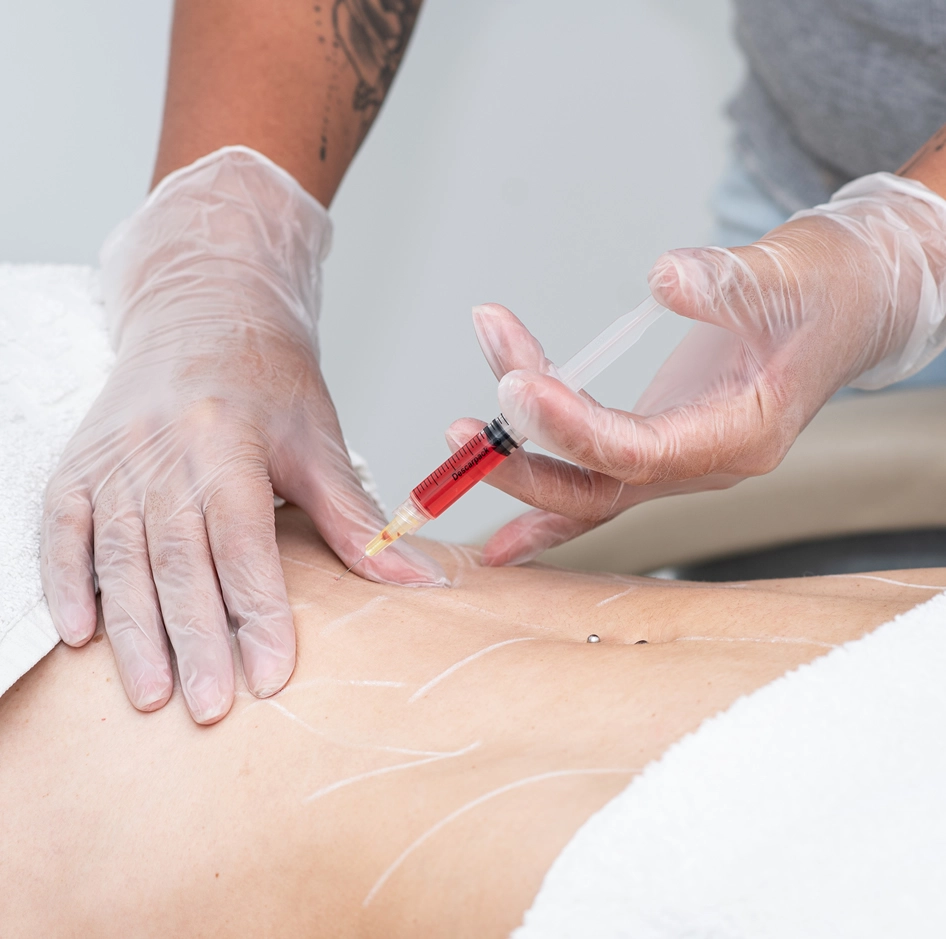 Lipo Enzimática Clínica de Estética BH