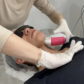 Ultraformer MPT – Clínica de Estética BH